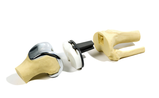 KNEE REPLACEMENT KIT